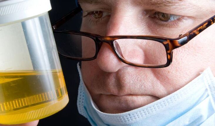 Kronik prostatit için idrar analizi