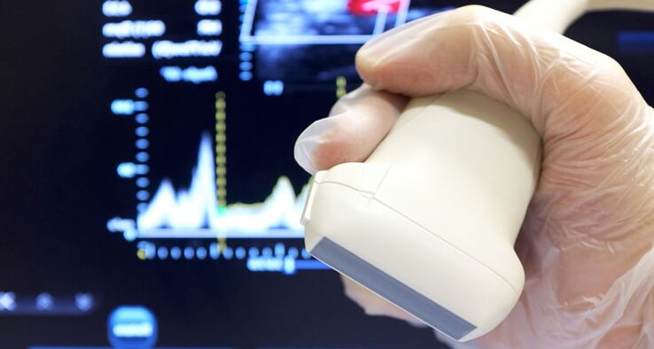 Kronik prostatitin ultrason tanısı